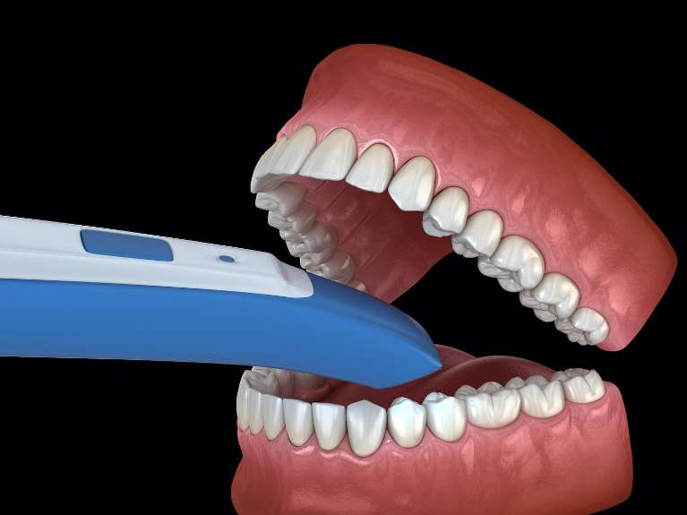 Intraoral Camera